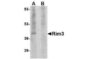 Image no. 1 for anti-Regulating Synaptic Membrane Exocytosis 3 (RIMS3) (N-Term) antibody (ABIN1495404) (RIMS3 抗体  (N-Term))