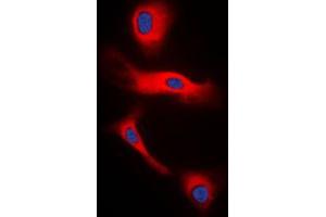 Immunofluorescent analysis of Glucagon staining in H9C2 cells. (Glucagon 抗体  (Center))