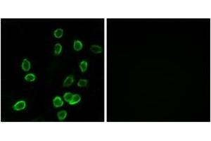 Immunofluorescence analysis of A549 cells, using ATP5G3 Antibody.