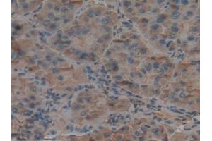 Immunohistochemistry (IHC) image for anti-Complement Component 3 (C3) (AA 1000-1326) antibody (ABIN7432772)