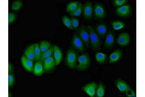 Immunofluorescent analysis of A549 cells using ABIN7170798 at dilution of 1:100 and Alexa Fluor 488-congugated AffiniPure Goat Anti-Rabbit IgG(H+L) (STOML1 抗体  (AA 79-290))