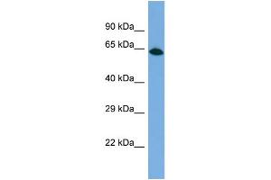 Western Blotting (WB) image for anti-KIAA1949 (KIAA1949) (C-Term) antibody (ABIN2784993) (KIAA1949 抗体  (C-Term))