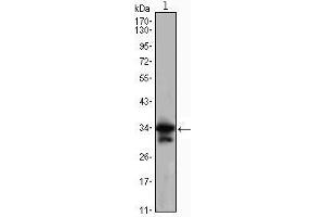 Western Blot showing CDC2 antibody used against Jurkat (1) cell lysate. (CDK1 抗体)