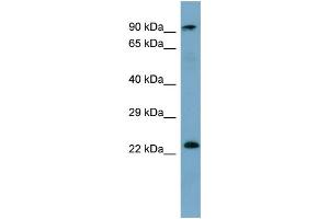 WB Suggested Anti-KRAS Antibody Titration: 0. (K-RAS 抗体  (N-Term))