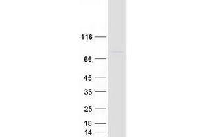 Validation with Western Blot