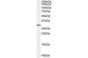 Western Blotting (WB) image for anti-Family with Sequence Similarity 107, Member B (FAM107B) (Middle Region) antibody (ABIN2774503) (FAM107B 抗体  (Middle Region))