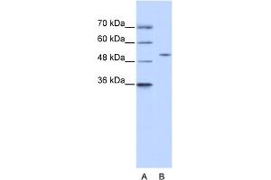 WB Suggested Anti-ZNF555 Antibody Titration:  0. (ZNF555 抗体  (N-Term))