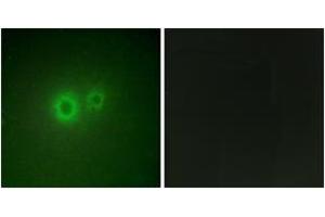 Immunofluorescence analysis of HuvEc cells, using LRAT Antibody. (LRAT 抗体  (AA 111-160))