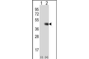 Western blot analysis of TPST1 (arrow) using rabbit polyclonal TPST1 Antibody  (ABIN650705 and ABIN2839242). (TPST1 抗体  (C-Term))