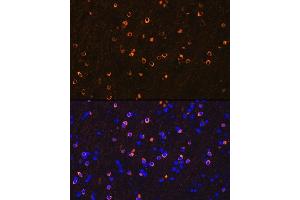 Immunofluorescence analysis of mouse brain using NMD Rabbit mAb (ABIN7267417) at dilution of 1:100 (40x lens). (GRIN1/NMDAR1 抗体)