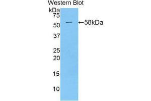Western Blotting (WB) image for anti-Myxovirus Resistance Protein 1 (MX1) (AA 400-652) antibody (ABIN1859914) (MX1 抗体  (AA 400-652))