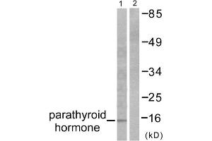 Western blot analysis of extracts from A549 cells, using Parathyroid Hormone antibody (ABIN5976482). (PTH 抗体  (Internal Region))