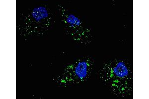 Fluorescent image of  cells stained with SQSTM1 (p62) (C-term) antibody. (SQSTM1 抗体  (AA 317-346))