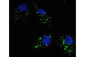 Fluorescent image of  cells stained with SQSTM1 (p62) (C-term) antibody. (SQSTM1 抗体  (AA 317-346))