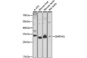 Western blot analysis of extracts of various cell lines, using GNPDA1 antibody (ABIN6292107) at 1:3000 dilution. (GNPDA1 抗体)