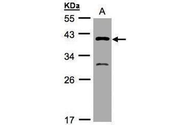 GIPC3 anticorps  (N-Term)