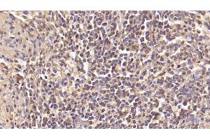 Detection of INSR in Human Spleen Tissue using Monoclonal Antibody to Insulin Receptor (INSR) (Insulin Receptor 抗体)