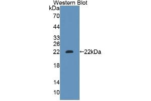 Detection of Recombinant GCDH, Human using Polyclonal Antibody to Glutaryl Coenzyme A Dehydrogenase (GCDH) (GCDH 抗体  (AA 270-438))