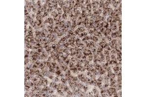 Immunohistochemical staining of human liver with TACC2 polyclonal antibody  shows strong cytoplasmic positivity in hepatocytes at 1:50-1:200 dilution. (TACC2 抗体)