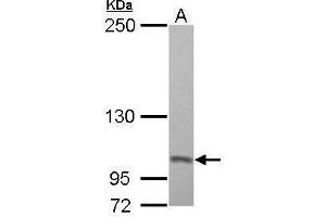 WB Image Sample (30 ug of whole cell lysate) A: A431 5% SDS PAGE antibody diluted at 1:500