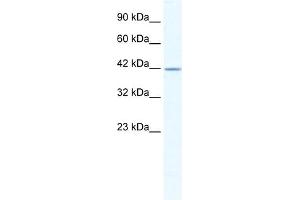 Western Blotting (WB) image for anti-gamma-aminobutyric Acid (GABA) A Receptor, alpha 3 (GABRA3) (Middle Region) antibody (ABIN2776110)
