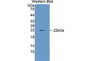 Western blot analysis of the recombinant protein. (TRPM7 抗体  (AA 19-179))