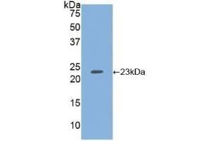 Detection of Recombinant HSPG, Human using Polyclonal Antibody to Heparan Sulfate Proteoglycan (HSPG) (HSPG 抗体  (AA 19-144))