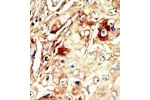 Image no. 2 for anti-WEE1 Homolog (S. Pombe) (WEE1) (Middle Region) antibody (ABIN360580) (WEE1 抗体  (Middle Region))