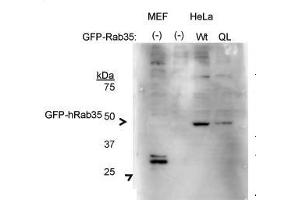 Human; RAB35 antibody - middle region validated by WB using HeLa cells, HEK293T cells at 1:500. (RAB35 抗体  (Middle Region))