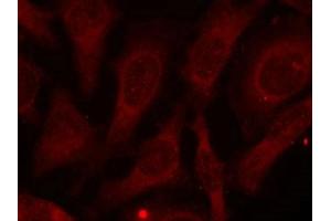 Immunofluorescence staining of methanol-fixed HeLa cells using CARM1 (Phospho-Ser228) antibody. (CARM1 抗体  (pSer228))