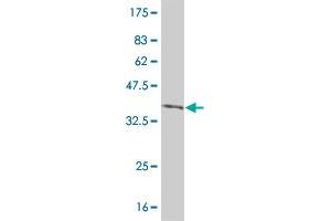 Western Blot detection against Immunogen (36. (IRAK2 抗体  (AA 111-210))