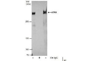 Immunoprecipitation (IP) image for anti-helicase 2, X-linked (ATRX) (C-Term) antibody (ABIN2855005)