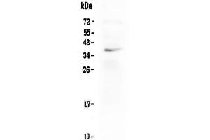 Western blot analysis of LOX-1/OLR1 using anti-LOX-1/OLR1 antibody . (OLR1 抗体  (Middle Region))