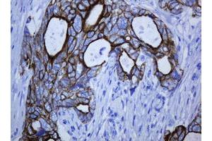 Image no. 3 for anti-Keratin 5 (KRT5) (AA 1-273) antibody (ABIN1490696) (Cytokeratin 5 抗体  (AA 1-273))