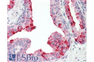 ABIN1781957 (5µg/ml) staining of paraffin embedded Human Prostate. (CUTA 抗体  (C-Term))