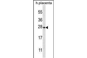 Western blot analysis in human placenta tissue lysates (35ug/lane). (SNAP23 抗体  (C-Term))