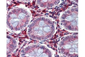 Immunohistochemistry (IHC) image for anti-Insulin-Like Growth Factor Binding Protein 4 (IGFBP4) (Middle Region) antibody (ABIN2782316) (IGFBP4 抗体  (Middle Region))