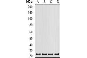 Western Blotting (WB) image for anti-Proteasome (Prosome, Macropain) Subunit, beta Type 2 (PSMB2) antibody (ABIN7306308)