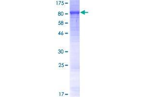 Image no. 1 for Leucine Rich Repeat Containing 40 (LRRC40) (AA 1-602) protein (GST tag) (ABIN1309771) (LRRC40 Protein (AA 1-602) (GST tag))