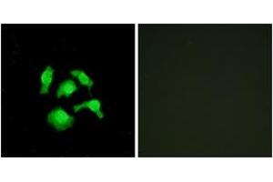 Immunofluorescence analysis of HepG2 cells, using TSC22D1 Antibody. (TSC22D1 抗体  (AA 71-120))