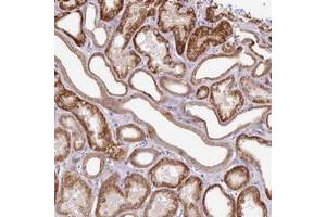 Immunohistochemical staining of human kidney with ZNF234 polyclonal antibody  shows strong cytoplasmic positivity in renal tubules. (ZNF226 抗体)