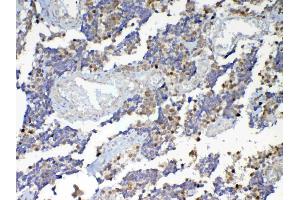 IHC analysis of Dnmt1 using anti-Dnmt1 antibody . (DNMT1 抗体  (AA 22-126))