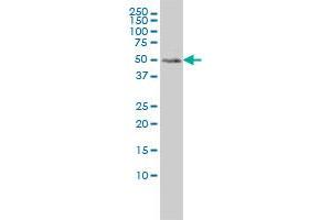 Western Blotting (WB) image for anti-Meis Homeobox 2 (MEIS2) (AA 1-382) antibody (ABIN598810) (MEIS2 抗体  (AA 1-382))