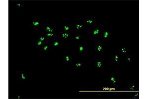 Immunofluorescence of purified MaxPab antibody to LYAR on HeLa cell. (LYAR 抗体  (AA 1-379))