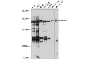 Western blot analysis of extracts of various cell lines, using SYMPK antibody (ABIN6128787, ABIN6148761, ABIN6148762 and ABIN6224767) at 1:1000 dilution. (Symplekin 抗体  (AA 310-530))