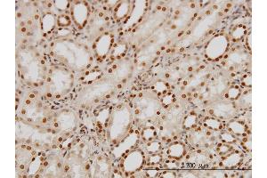 Immunostaining (ISt) image for anti-Polypyrimidine Tract Binding Protein 1 (PTBP1) (AA 45-144) antibody (ABIN562502)
