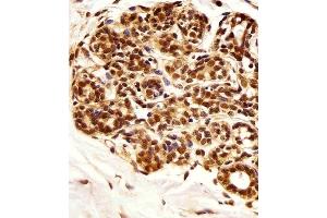 Immunohistochemical analysis of paraffin-embedded H. (PIN1 抗体)