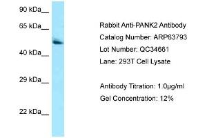Western Blotting (WB) image for anti-Pantothenate Kinase 2 (PANK2) (C-Term) antibody (ABIN2789627) (PANK2 抗体  (C-Term))