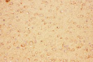Anti-CNTF Picoband antibody,  IHC(P): Mouse Brain Tissue (CNTF 抗体  (AA 2-200))