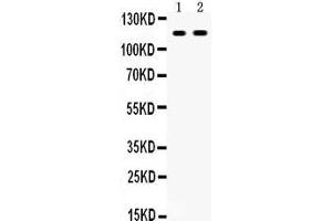 Anti- CD44 Picoband antibody, Western blotting All lanes: Anti CD44  at 0. (CD44 抗体  (N-Term))